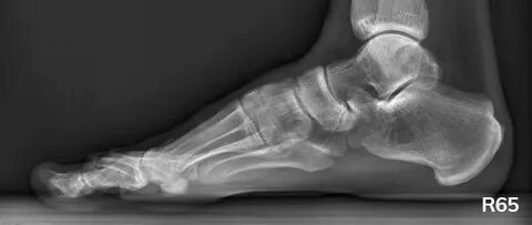 Порно сперматозоид теңіз жасанды