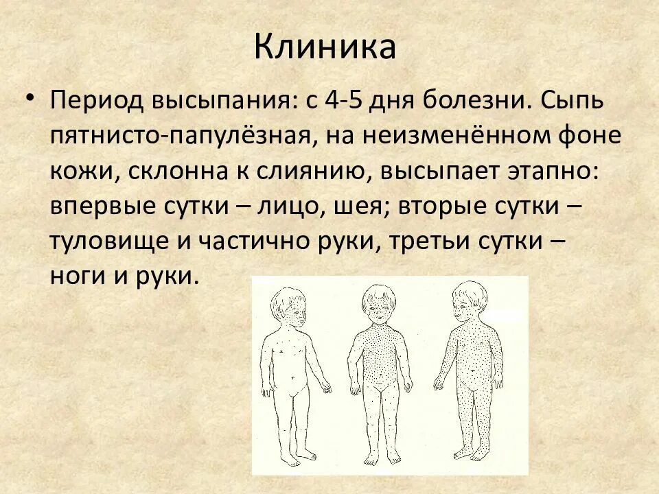 Этапность появления сыпи при кори. Петнистопапулезная сыпь. Что такое сыпь пятнистопулёзная. Gznybcnj-gfgektpyfz CGM.