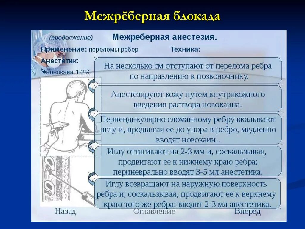 Блокада техника выполнения. Межреберная проводниковая анестезия. Анестезия при переломе ребер. Проводниковая анестезия при переломе ребер.