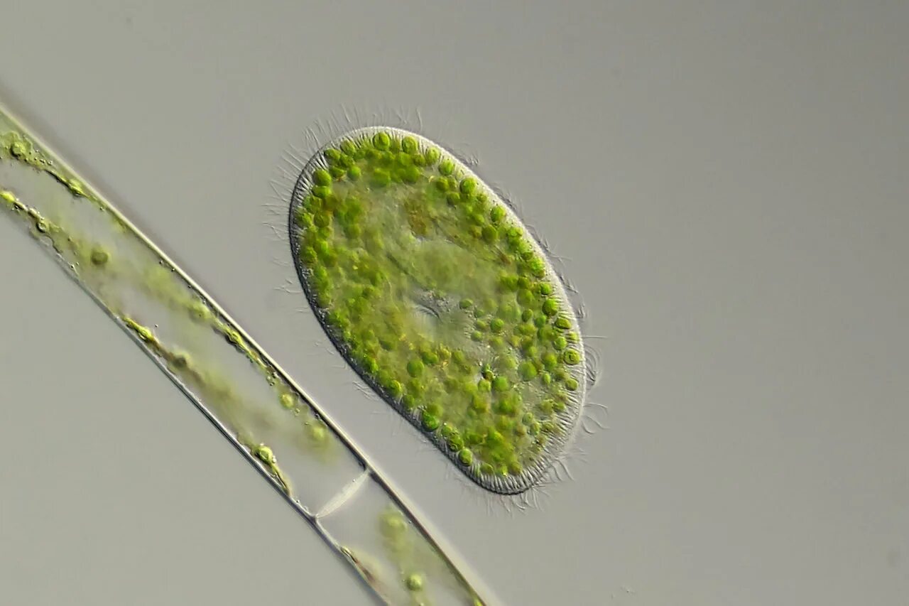 подофрия инфузория. инфузория туфелька водоросль. инфузория бурсария. инфузория туфелька бурсария. инфузория туфелька циста.
