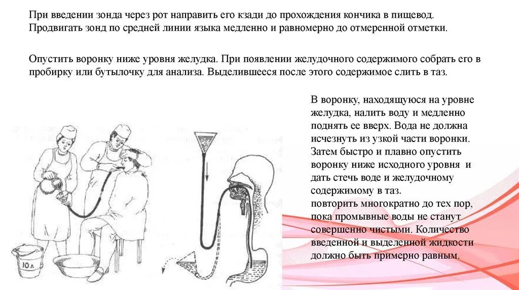 Промывание желудка через зонд. Введение зонда через рот. Постановка желудочного зонда через рот. Введение желудочного зонда. Введение зонда в желудок через рот.