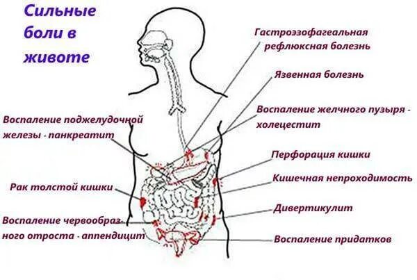 Боли в кишечнике внизу живота у мужчин