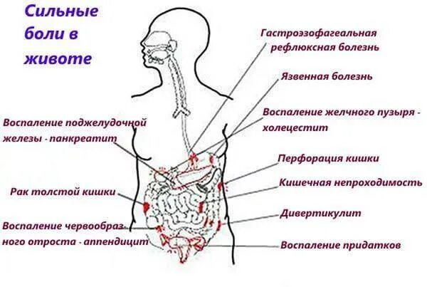 Боль внизу живота больно. Боль слева внизу живота у мужчин. Сильно болит левая сторона живота снизу. Болит в нижней части живота слева. Болит в нижней части живота слева у мужчин.