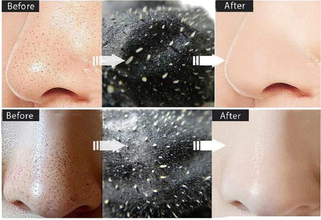 Маска от точек на носу. I&#039;m petie маска для лица от черных точек blackhead remover charcoal mask - nose strip, 15 g. маска от черных точек для лица black head, 6г. lanbena черных точек black. маска для очищения носа от черных точек lanbena, 30ml.