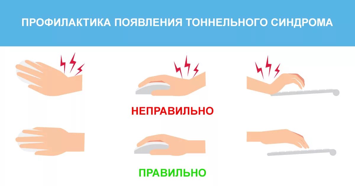 Туннельный синдром запястья кисти. Карпальный туннельный синдром запястья упражнения. Синдром канала запястья профилактика. Тоннельный синдром запястного канала профилактика. Туннельный синдром после операции