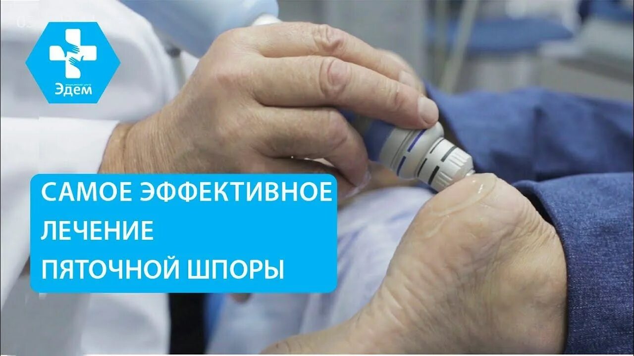 Лечение шпоры в самаре. Лечение шпоры в самаре. Лечение шпоры в самаре. Как лечить шпору народными средствами. Лечение шпор народными средствами.