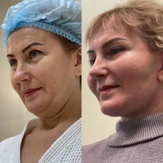 Белый пластический