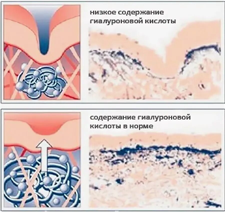 Tete гиалуроновая кислота 100%. Как вырабатывается гиалуроновая кислота в организме человека. Гиалуроновая кислота 3 мл. Низкомолекулярная гиалуроновая кислота. Гиалуроновая кислота.