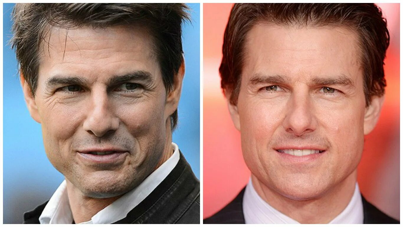 Маурисио гальди. Пластические операции артистов. Маурисио гальди 2020. Роналду до виниров. Пластика звезд.