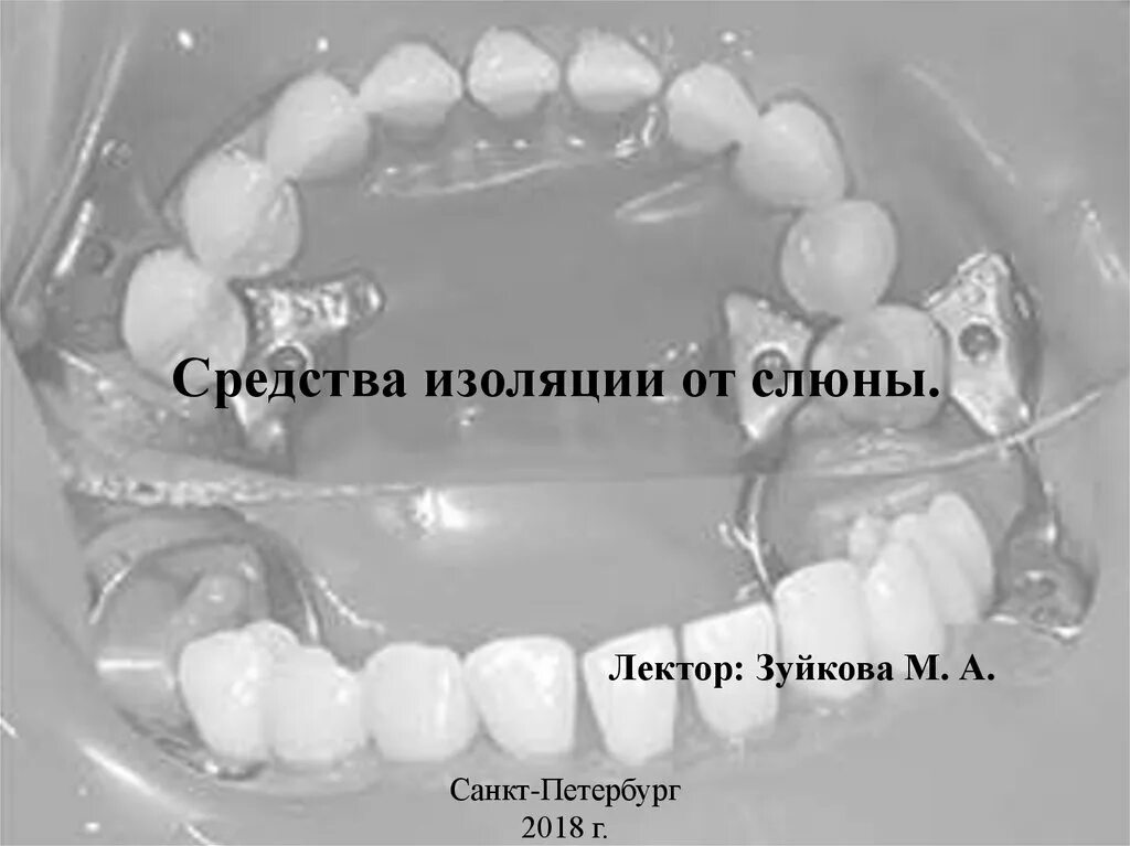 Изоляция зуба от слюны. Средства изоляции от слюны. изоляция от слюны в стоматологии. средства изоляции от ротовой жидкости.. средства изоляции рабочего поля от слюны в стоматологии.