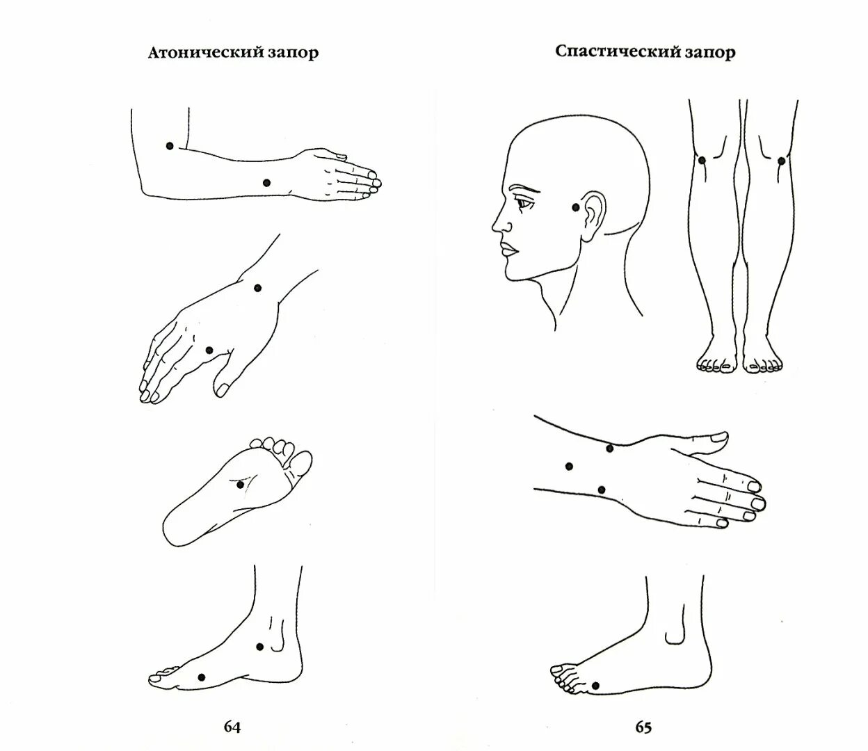 Точки самомассажа. Точечный массаж (точки Жень-Чжун, Чэн-Цзян, Хэ ГУ).. Точечный массаж Акупрессура при болях. Точечный массаж (точки Жень-Чжун. Чэн-Цзян).. Акупрессура точечный массаж акупунктура.