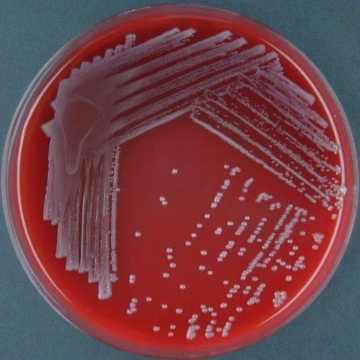 Коклюш бактериальная. Bordetella pertussis на питательной среде. Бордетеллы коклюша. Колонии Bordetella pertussis. Среда борде Жангу коклюш.