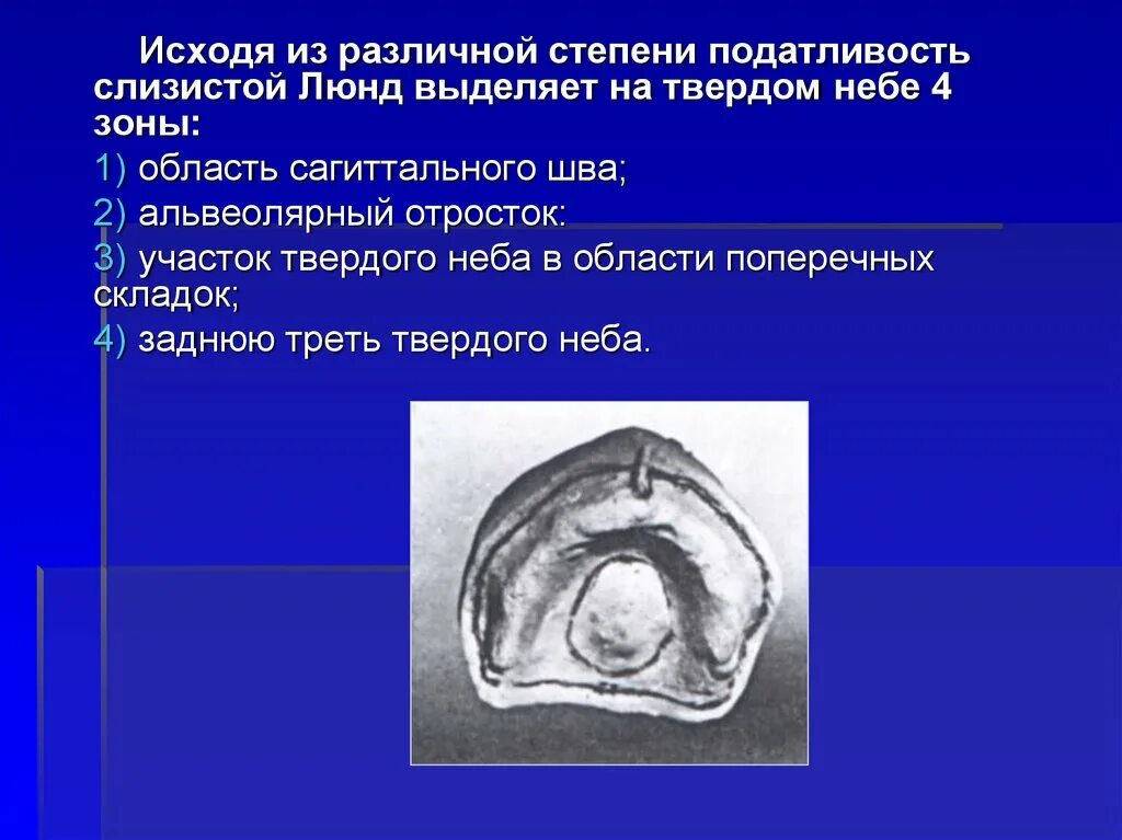 Зона податливости слизистой оболочки. Область сагиттального шва твердого неба. Степени податливости слизистой. Зоны податливости слизистой оболочки. Классификация податливости слизистой оболочки.