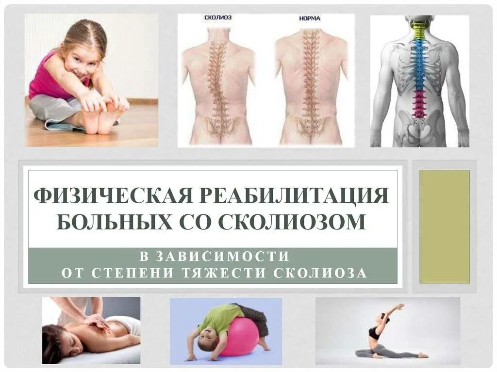 Сколиоз позвоночника у взрослых лечение гимнастика. Методы реабилитации при сколиозе. сколиоз позвоночника гимнастика. реабилитация сколиоза у детей. сколиоз позвоночника реабилитация.
