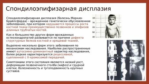 Низкая дисплазия