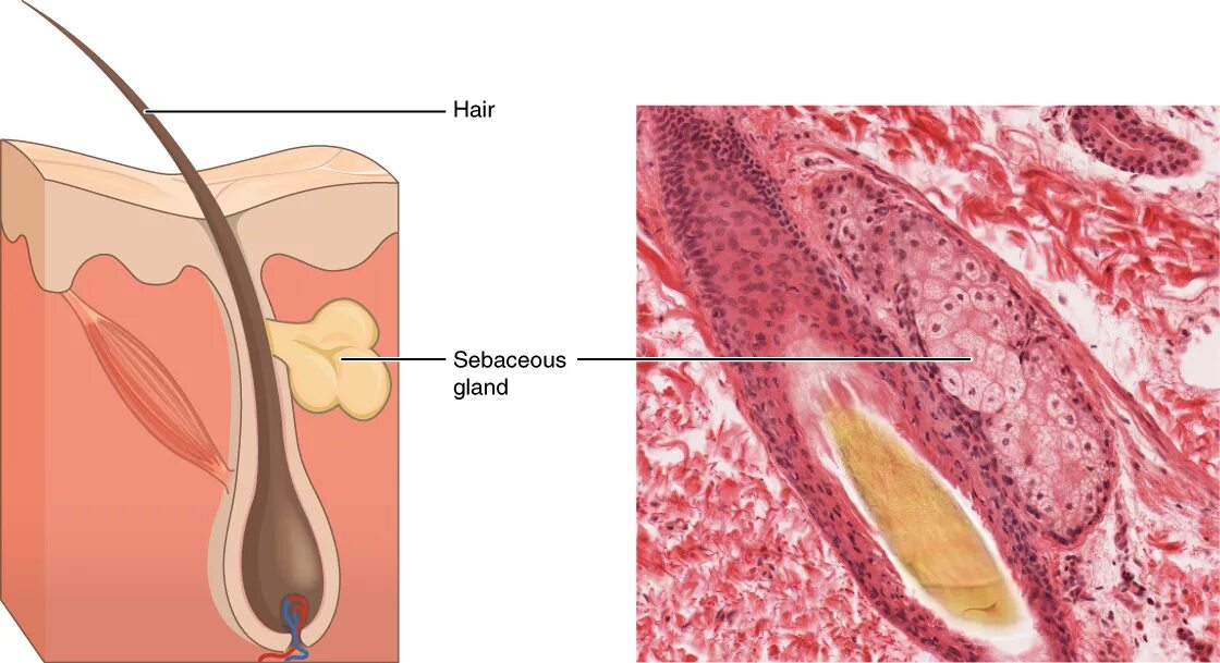 Сальные железы (sebaceous Glands). Закупоренный выводной проток сальной железы. Фурункулез волосяных фолликулов. Закупоривание сальной железы.