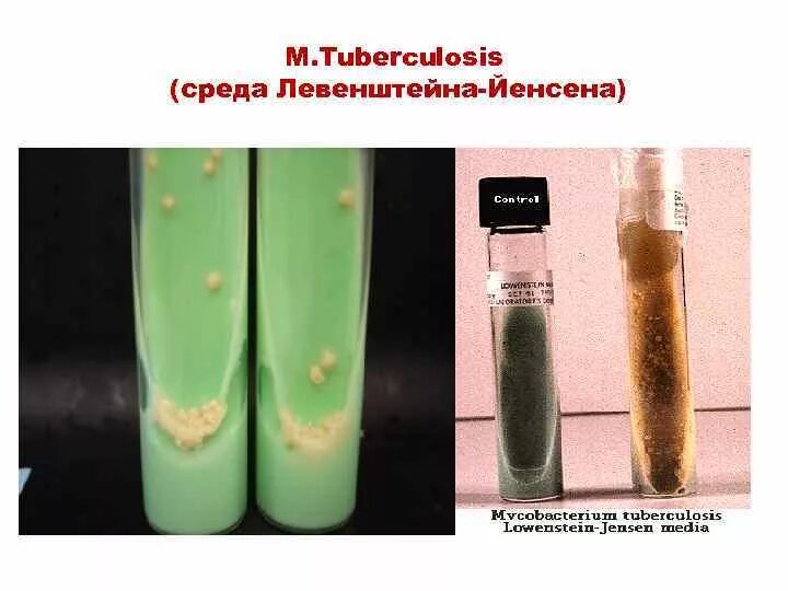 Плотная и жидкая среда. Среда Левенштейна-Йенсена туберкулез. Возбудитель туберкулеза на среде Левенштейна Йенсена. Посев на Левенштейна Йенсена. Компоненты среды Левенштейна Йенсена.