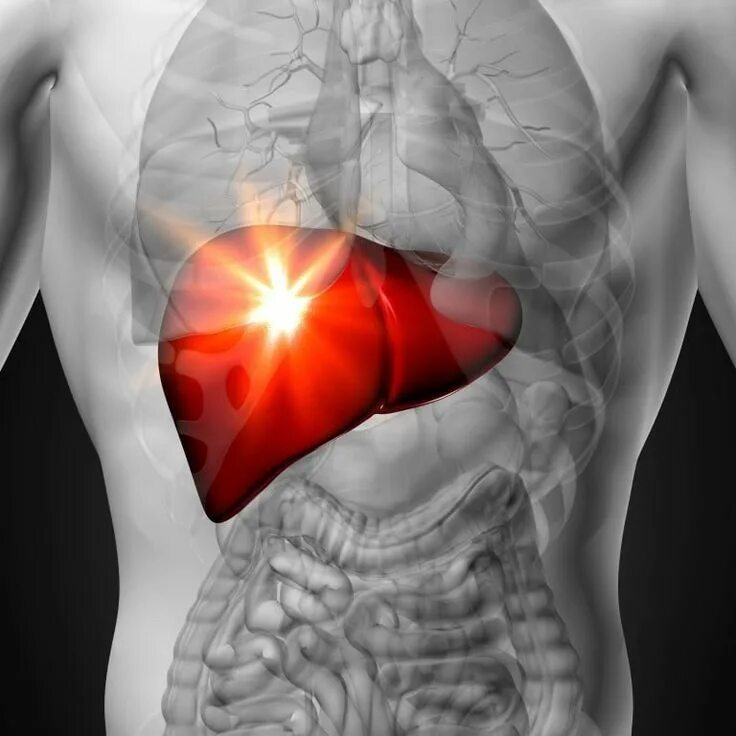 Liver disease. Холестатические заболевания печени. Печень анатомия человека. Liver disease. Печенеь челове.
