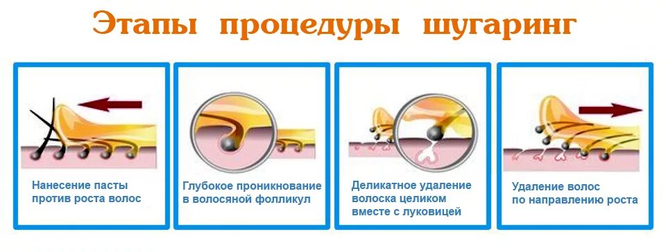 Депиляция по росту или против роста. Схемы нанесения пасты для шугаринга. схема нанесения сахарной пасты. этапы процедуры шугаринга. шугаринг против роста волос или по росту.