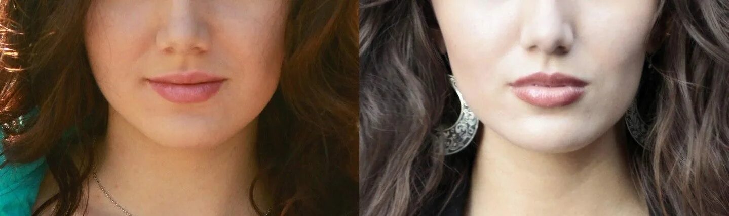 Как меняется лицо после удаления зуба. Изменение лица после брекетов. Лицо до и после удаления зубов мудрости. Лицо после удаления зубов мудрости. Лицо до зубов мудрости и после.