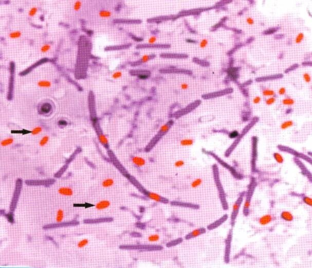 Окраска спор бактерий. Bacillus anthracis микроскопия. Сибирская язва окраска по Ожешко. Возбудитель сибирской язвы окраска по Ожешко. Bacillus anthracis Сибирская язва.