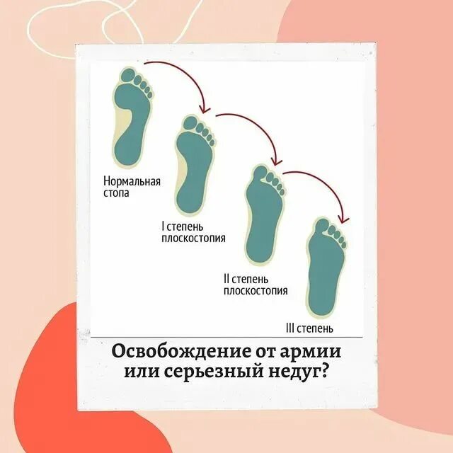 Берут ли с плоскостопием 3 степени. Поперечное и комбинированное плоскостопие 1--2 степени. Продольное плоскостопие 3-й степени. Плоскостопие 3 и 4 степени. Плоскостопие 3й степени градусы.