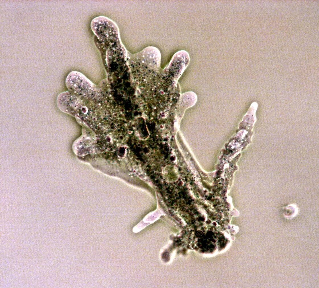 одноклеточные строение амебы. саркодовые строение клетки. питание амебы протей. внешний вид строение и движение амебы 7 класс. ядро амебы обыкновенной.