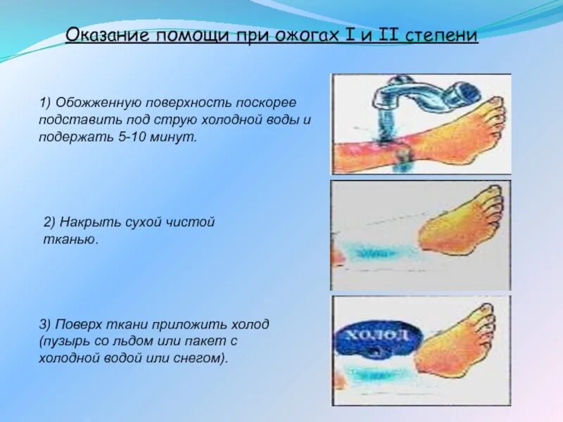 Обработка ожогов водой. Оказание первой при термических ожогах. Помощь при термическом ожоге 3 степени. Термический ожог первой и второй степени.