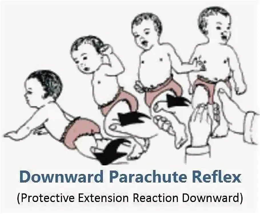 Парашютный рефлекс. Парашютный рефлекс у ребенка. Рефлекс опоры у новорожденных.