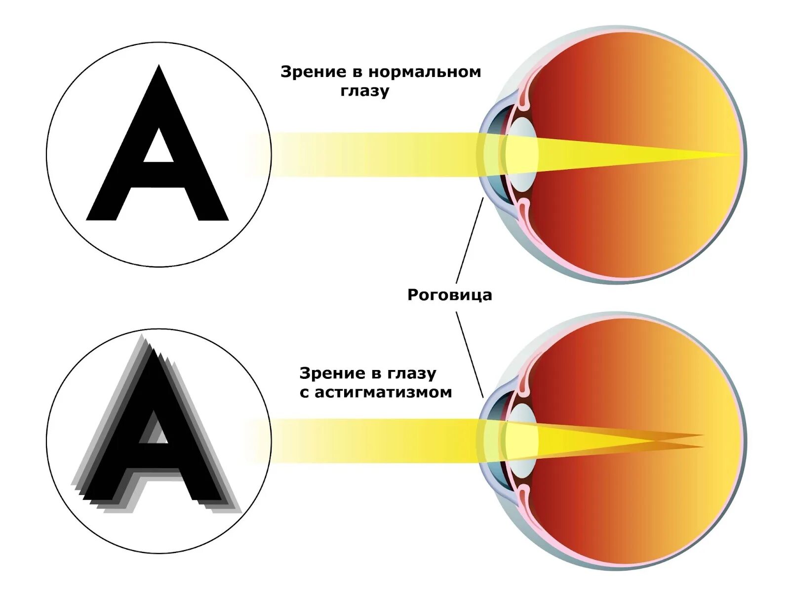 Мир с астигматизмом