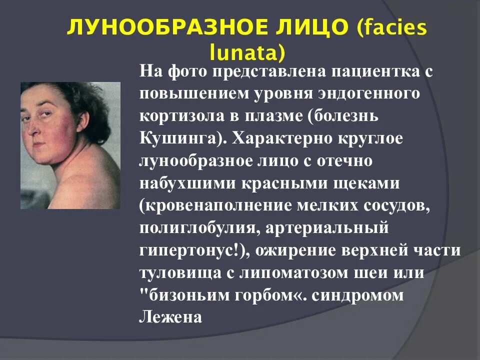 Преднизолон синдром кушинга