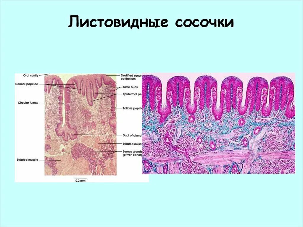Строение языка гистология. Листовидный сосочек языка гистология. вкусовая луковица листовидные сосочки языка. листовидный сосочек языка гистология препарат. вкусовые почки (листовидные сосочки языка).