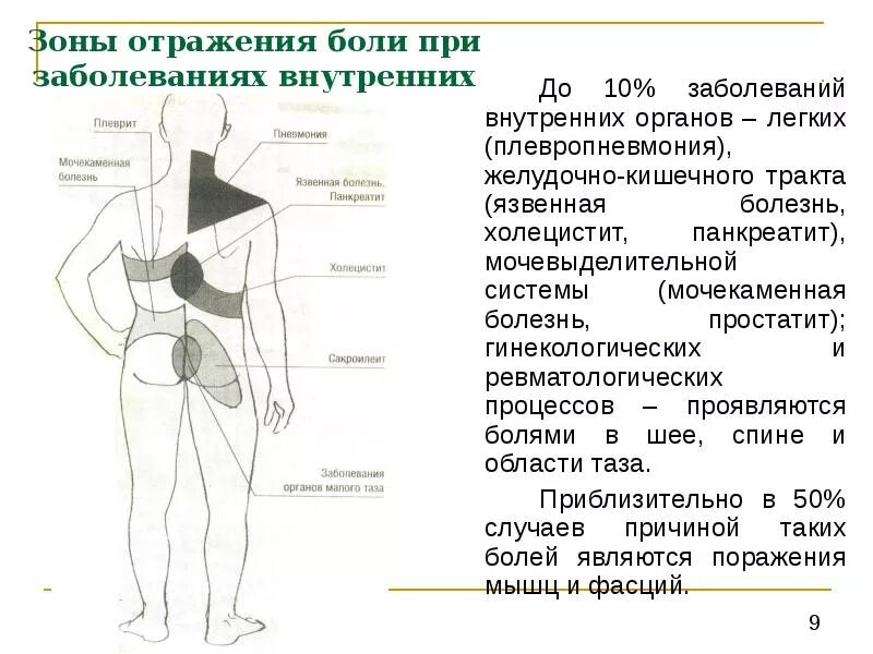 Отдает в левый бок поясницы. Локализация боли в спине. Локализация болей в спине схема.