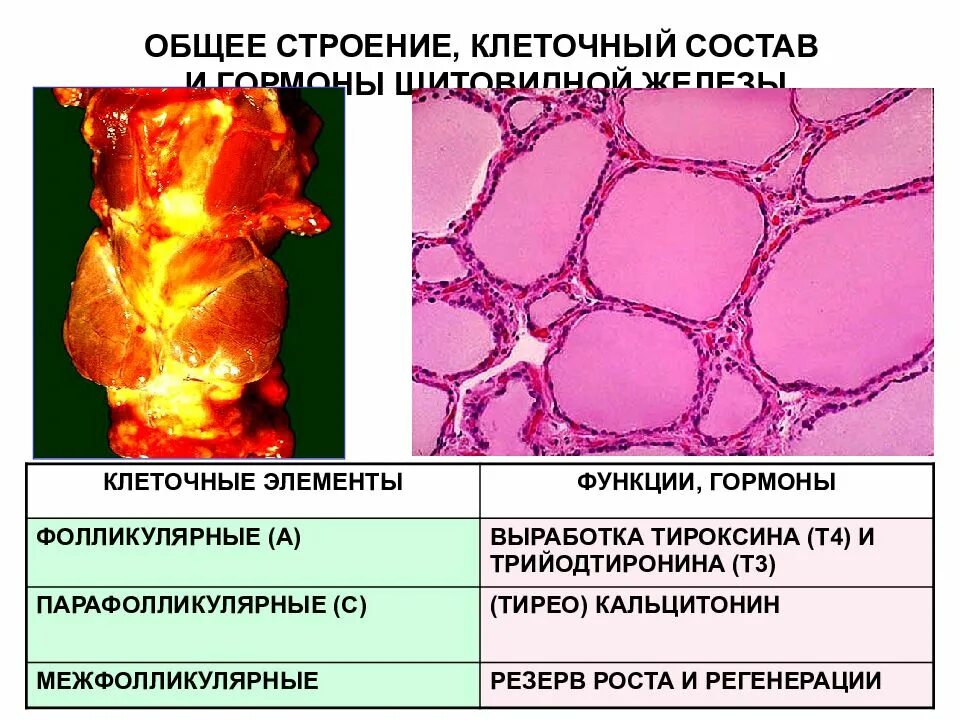 Гормоны щитовидной железы гистология. Гормоны щитовидной жеолезыгистология. Гиперфункция щитовидной железы гистология. Строение щитовидной железы гистология. Какие железы вырабатывают тироксин