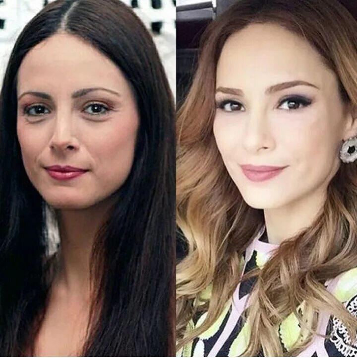 Мине тугай до пластики в молодости. Мине тугай до пластики. Мине тугай до пластики. Мине тугай пластика до и после. Мине тугай до пластики.