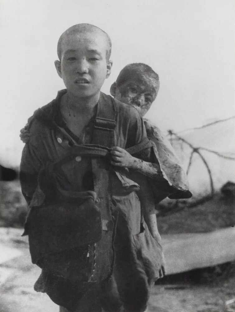 Япония 1945 хиросима и нагасаки. Хиросима и нагасаки жертвы. Хиросима и нагасаки 1945 люди. Нагасаки люди. Хиросима и нагасаки жертвы.