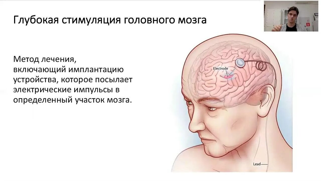 Стимуляция мозга ребенка