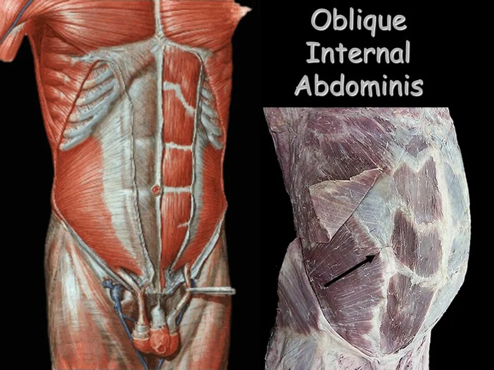 Передняя прямая мышца живота. Transversus abdominis мышца. Апоневроз живота анатомия. Rectus abdominis muscle.