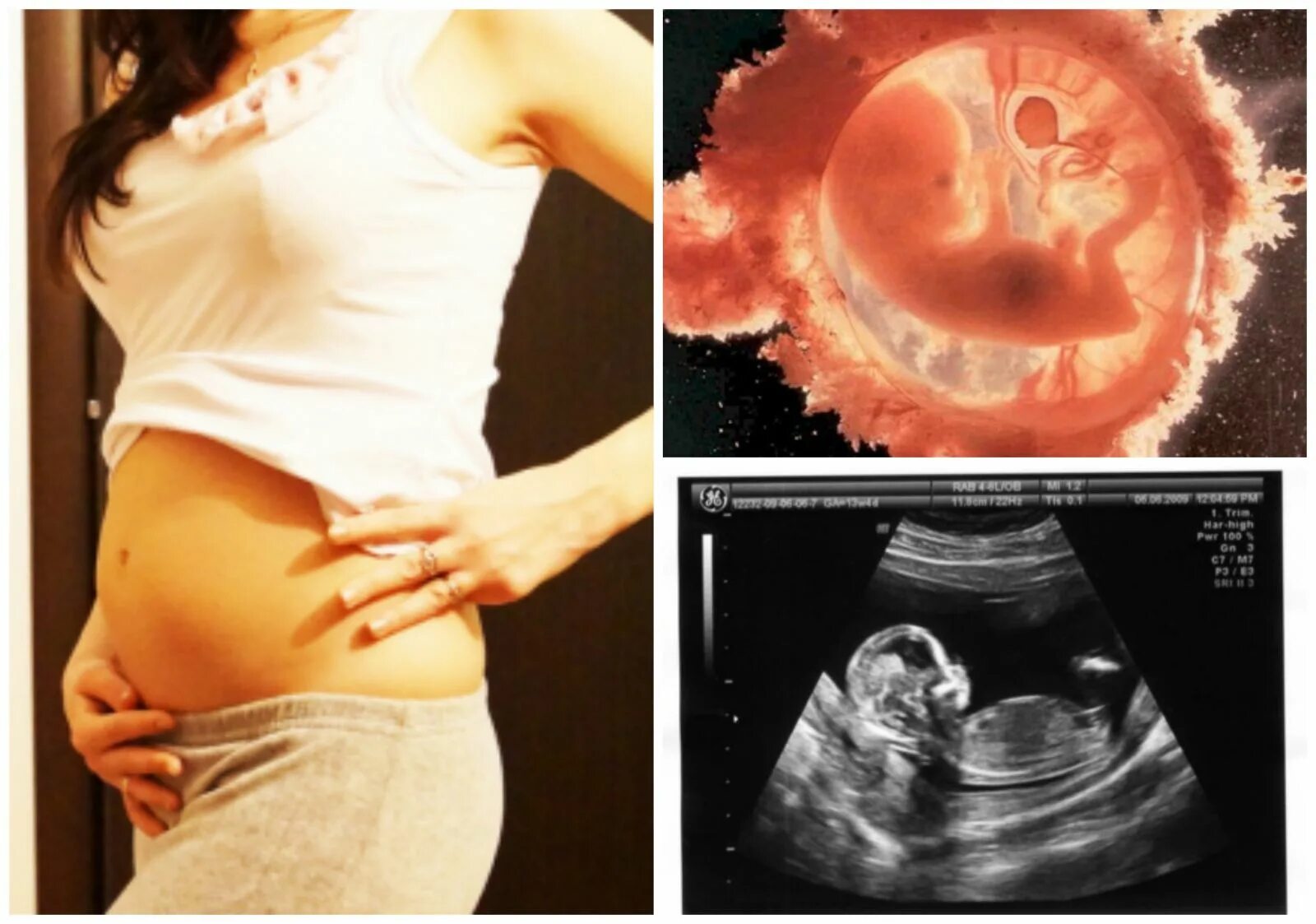 Ребенок на 13 неделе беременности УЗИ. Размер эмбриона в 13 недель беременности. 13 Недель беременности фото плода на УЗИ.