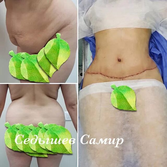 ашкар самир серханович. седышев самир хасанович пластический. седышев самир пластический. самир хасанович пластический хирург. седышев самир пластический хирург.