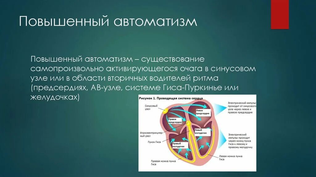 Повышенный автоматизм. Факторы повышения АВТОМАТИЗМА. Факторы повышения АВТОМАТИЗМА сердца. Автоматизм и ритм сердца. Амбулаторный автоматизм