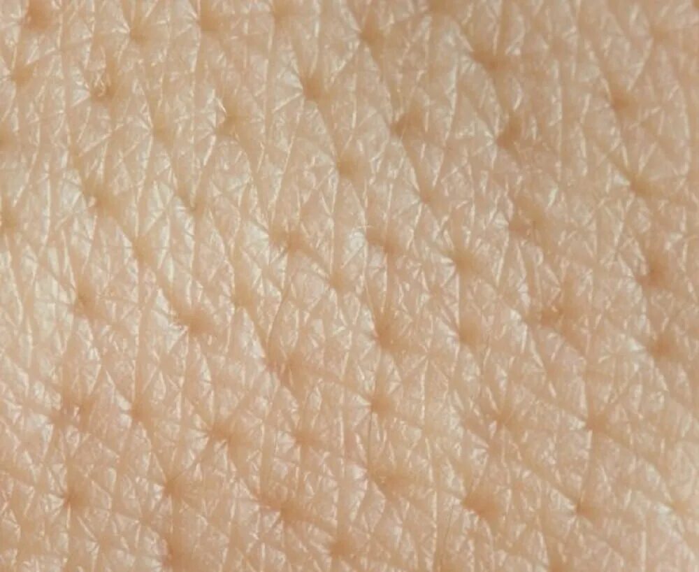 Клетки кожи. Клетки кожи человека. Кожа человеческая. Текстура человеческой кожи. Кожа внешний вид