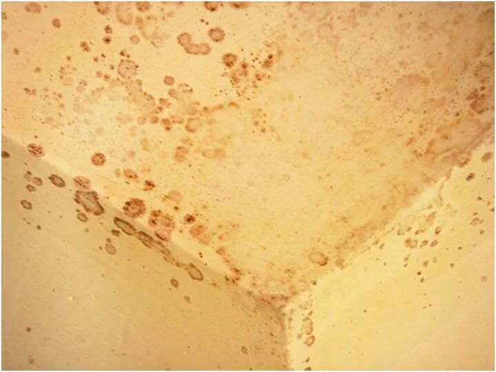 Плесень в ванной на потолке. Коричневая плесень на стенах. Грибок на потолке. Желтый грибок на стенах. Грибок под обоями.