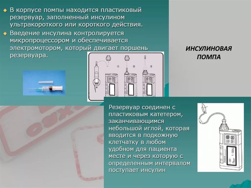 Принцип инсулиновой помпы. Устройство инсулиновой помпы. инсулиновая помпа принцип работы. резервуар для инсулиновой помпы.