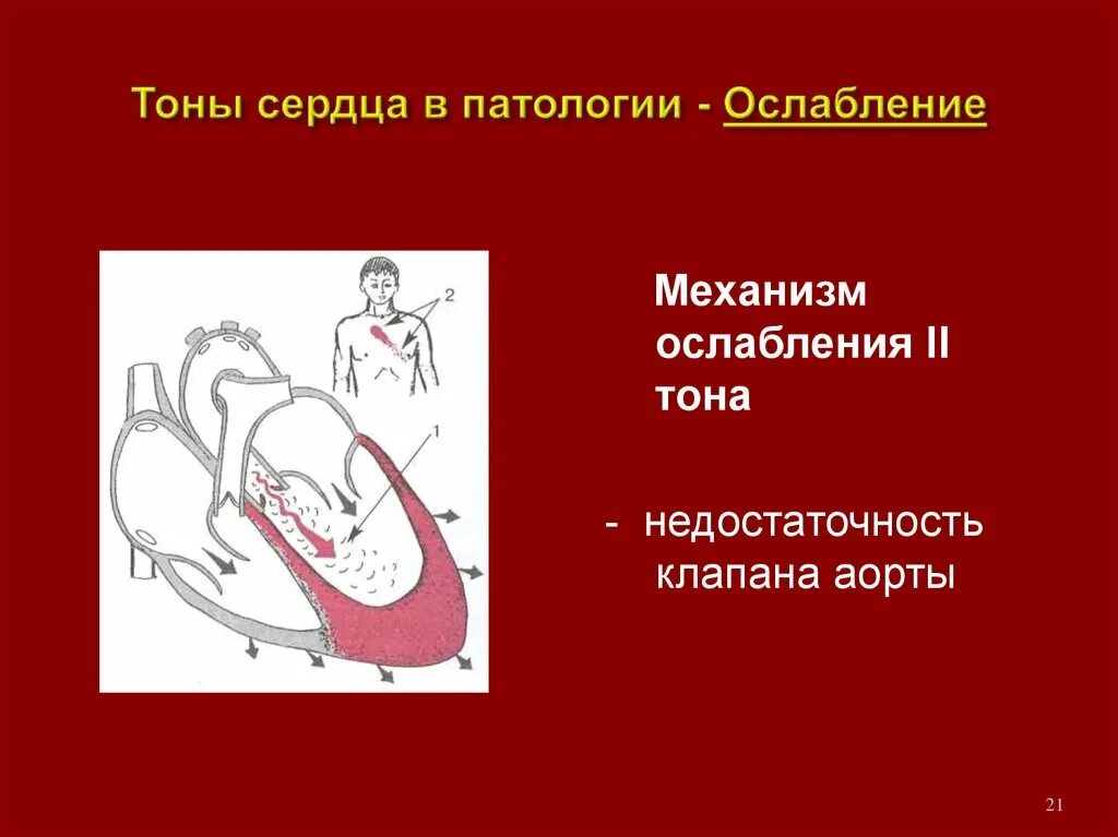 Ослабленные тоны сердца. Тоны сердца патология. Патологические тоны сердца. Сердце и тоны сердца. Сердечные тоны патологические.