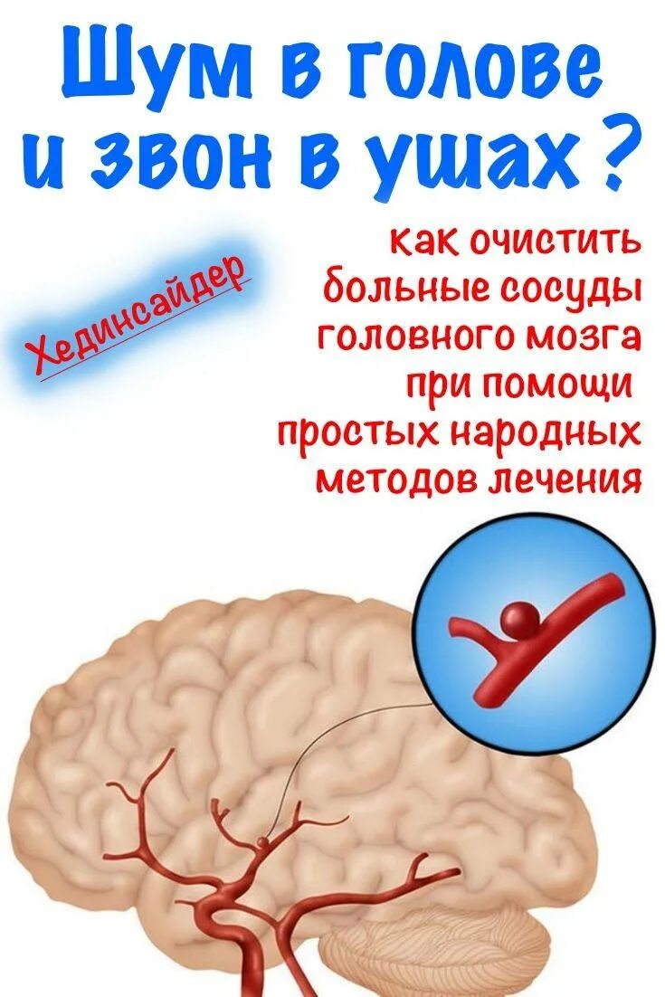 Сосуды головы шум в ушах. Звон в голове. Если звон в голове что это такое.