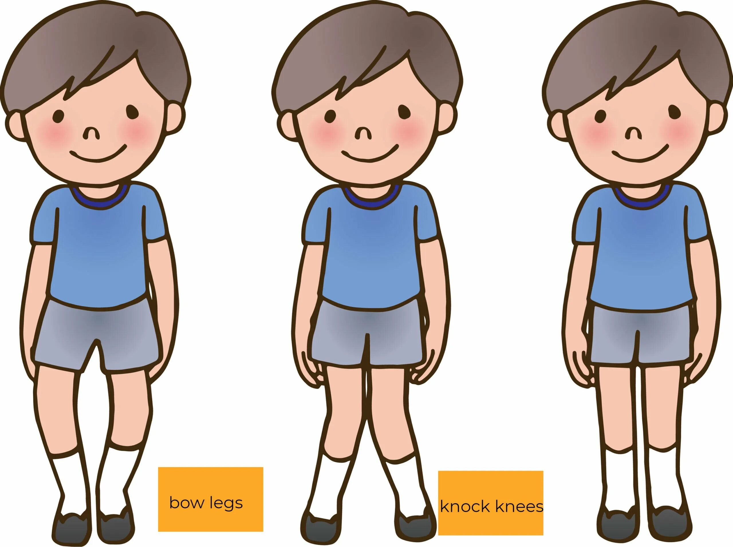Children usually. Bow legged. Five Legs картинки для детей.
