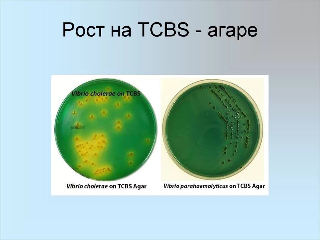 Холера питательные среды. Рост холерного вибриона на щелочном агаре. TCBS агар холерный вибрион. Холерный вибрион на питательных средах. Холерный вибрион колонии.