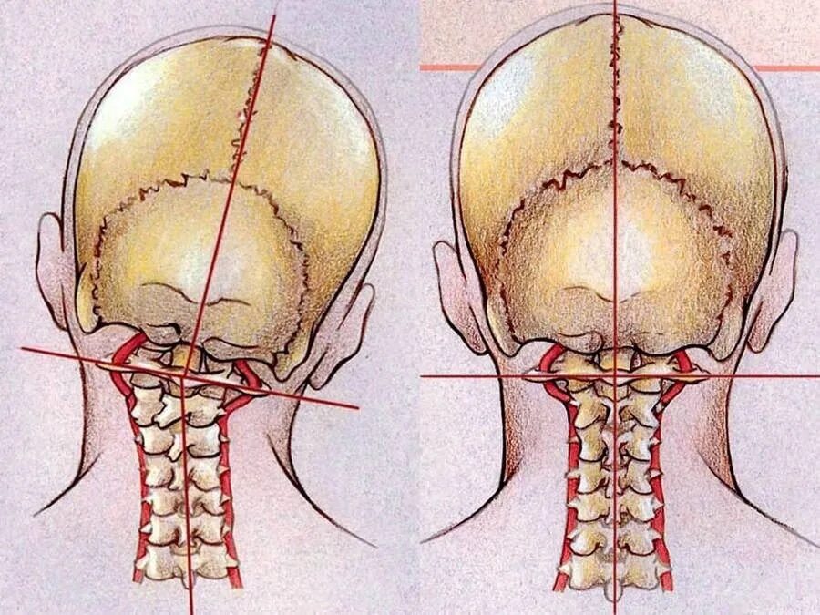 Височно-нижнечелюстной сустав и осанка. Позвоночник у основания черепа.