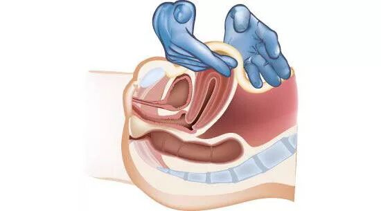 Массаж матки после родов. Массаж матки гинекологический. Гинекологический массаж при бесплодии.